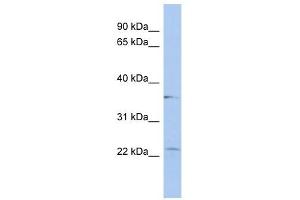 LYSMD2 antibody used at 1 ug/ml to detect target protein. (LYSMD2 anticorps  (Middle Region))