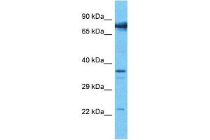 Host:  Rabbit  Target Name:  COMP  Sample Type:  786-0 Whole Cell lysates  Antibody Dilution:  1. (COMP anticorps  (N-Term))