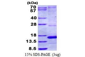 Image no. 2 for NADH Dehydrogenase (Ubiquinone) 1 alpha Subcomplex, 5, 13kDa (NDUFA5) (AA 1-116) protein (His tag) (ABIN6387051)