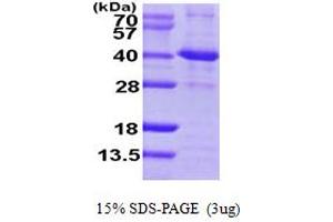 SDS-PAGE (SDS) image for Sirtuin 2 (SIRT2) (AA 1-352) protein (His tag) (ABIN6386645) (SIRT2 Protein (AA 1-352) (His tag))