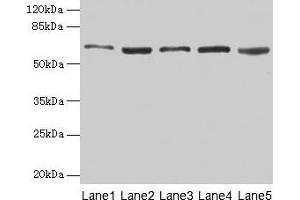 Western blot All lanes: STIP1 antibody at 12 μg/mL Lane 1: Hela whole cell lysate Lane 2: HepG2 whole cell lysate Lane 3: NIH/3T3 whole cell lysate Lane 4: Jurkat whole cell lysate Lane 5: Rat gonadal tissue Secondary Goat polyclonal to rabbit IgG at 1/10000 dilution Predicted band size: 63, 69, 60 kDa Observed band size: 63 kDa (STIP1 anticorps  (AA 1-543))