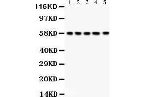 Anti- AGFG1 antibody, Western blotting All lanes: Anti AGFG1  at 0. (AGFG1 anticorps  (N-Term))