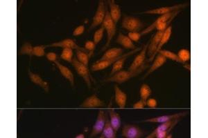 Immunofluorescence analysis of HeLa cells using PSMD13 Polyclonal Antibody at dilution of 1:100 (40x lens). (PSMD13 anticorps)