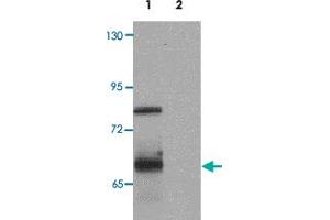 Western blot analysis of ORMDL1 in SK-N-SH Cell lysate with ORMDL1 polyclonal antibody  at 1 ug/mL (lane 1) and 2 ug/mL (lane 2). (ORMDL1 anticorps)