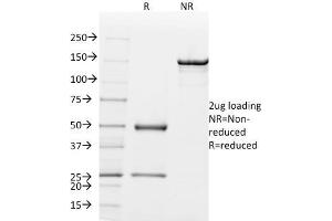 SDS-PAGE Analysis Purified Mammaglobin Mouse Monoclonal Antibody (MGB1/2000).