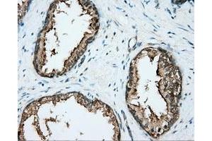 Immunohistochemical staining of paraffin-embedded liver tissue using anti-DNTTIP1 mouse monoclonal antibody.