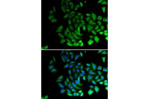Immunofluorescence analysis of U2OS cells using PIWIL1 antibody (ABIN6293460).