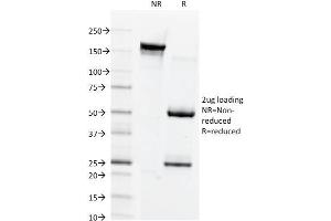 SDS-PAGE Analysis Purified Connexin 32 Mouse Monoclonal Antibody (Clone M12. (GJB1 anticorps)