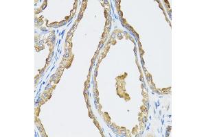 Immunohistochemistry of paraffin-embedded human prostate using CYP19A1 antibody (ABIN5971188) at dilution of 1/100 (40x lens).