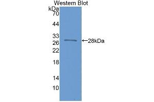 Detection of Recombinant NOS1AP, Human using Polyclonal Antibody to Nitric Oxide Synthase 1 Adaptor Protein (NOS1AP) (NOS1AP anticorps  (AA 285-506))