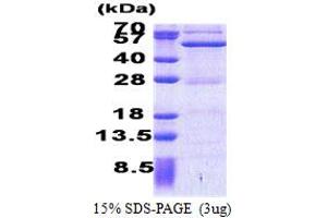 SDS-PAGE (SDS) image for Activating Signal Cointegrator 1 Complex Subunit 1 (ASCC1) (AA 1-357) protein (His tag) (ABIN5853210)