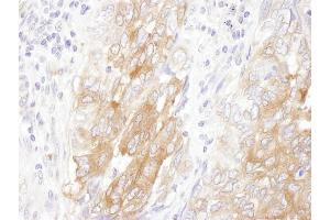 anti-Lin-28 Homolog B (LIN28B) (AA 200-250) antibody