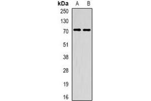 Western blot analysis of METTL3 expression in HepG2 (A), mouse spleen (B) whole cell lysates. (METTL3 anticorps)