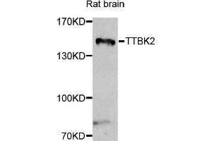 Western blot analysis of extracts of rat brain, using TTBK2 antibody. (TTBK2 anticorps)