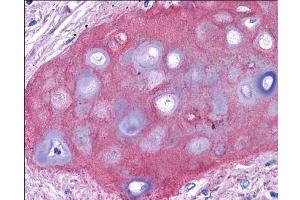 anti collagen II antibody (600-401-104 Lot 26014, 1:400, 45 min RT) showed moderate staining of in FFPE human bronchiolar cartilage (shown in image).