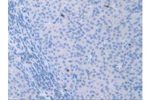 Figure. (ATF6 anticorps  (AA 1-377))