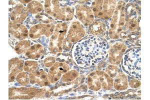 P4HB antibody was used for immunohistochemistry at a concentration of 4-8 ug/ml to stain Epithelial cells of renal tubule (arrows) in Human Kidney. (P4HB anticorps  (N-Term))