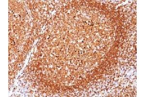 IHC testing of FFPE human tonsil stained with CD79a antibody (clone JCB117). (CD79a anticorps  (AA 202-216))
