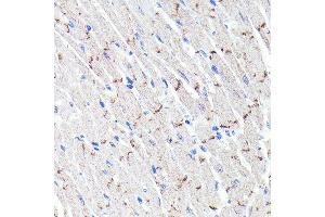 Immunohistochemistry of paraffin-embedded mouse heart using N-Cadherin Rabbit mAb (ABIN7265999) at dilution of 1:100 (40x lens).