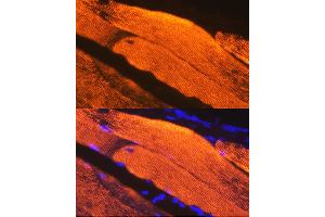 Immunofluorescence analysis of Mouse skeletal muscle using Calsequestrin 1 antibody (ABIN7266045) at dilution of 1:100. (Calsequestrin anticorps)