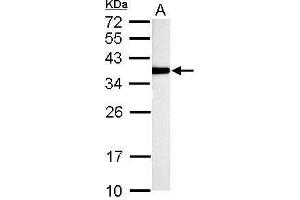 WB Image TST antibody detects TST protein by Western blot analysis. (TST anticorps)