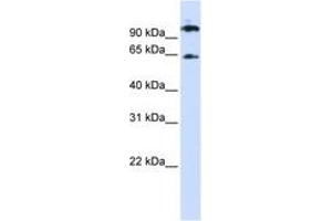 Image no. 1 for anti-Runt-Related Transcription Factor 1, Translocated To, 1 (Cyclin D-Related) (RUNX1T1) (AA 288-337) antibody (ABIN6744247) (RUNX1T1 anticorps  (AA 288-337))
