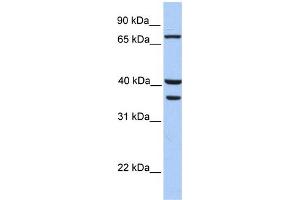 WB Suggested Anti-TGM5 Antibody Titration:  0. (Transglutaminase 5 anticorps  (C-Term))