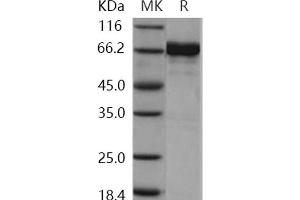 Western Blotting (WB) image for EPH Receptor A7 (EPHA7) (Active) protein (GST tag,His tag) (ABIN7317067)