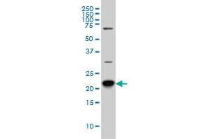 RAB8A monoclonal antibody (M02), clone 3G1 Western Blot analysis of RAB8A expression in Hela S3 NE . (RAB8A anticorps  (AA 108-207))