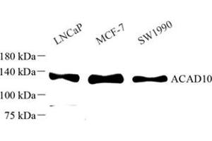 Western blot analysis of ACAD10 (ABIN7072924) at dilution of 1: 500 (ACAD10 anticorps)