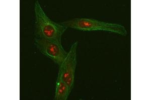 IF analysis of FOXO3A using anti-FOXO3A antibody (ABIN3042404) and anti-Beta Tubulin antibody (ABIN7602743). (FOXO3 anticorps  (AA 471-673))
