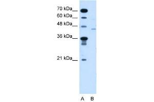 FKTN antibody used at 5 ug/ml to detect target protein. (Fukutin anticorps  (N-Term))