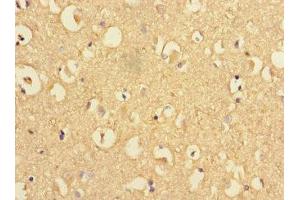 Immunohistochemistry of paraffin-embedded human brain tissue using ABIN7164264 at dilution of 1:100 (Presenilin 1 anticorps  (AA 4-218))