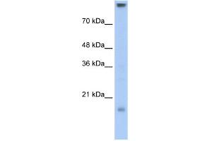 WB Suggested Anti-CLDN11 Antibody Titration:  0. (Claudin 11 anticorps  (C-Term))