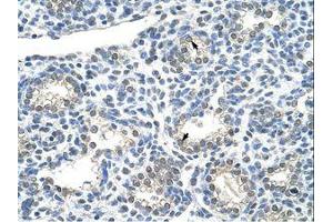 Image no. 1 for anti-Zinc Finger Protein 786 (ZNF786) (N-Term) antibody (ABIN203008)