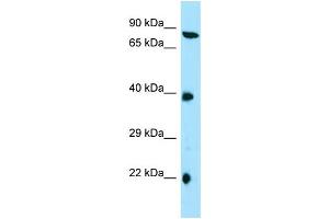 Western Blotting (WB) image for anti-Tetratricopeptide Repeat Domain 4 (TTC4) (C-Term) antibody (ABIN2790316) (TTC4 anticorps  (C-Term))