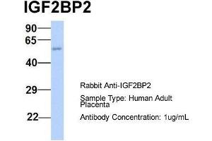 Host:  Rabbit  Target Name:  IGF2BP2  Sample Type:  Human Adult Placenta  Antibody Dilution:  1. (IGF2BP2 anticorps  (Middle Region))