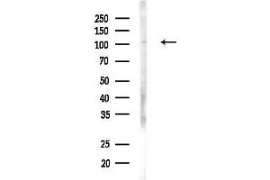 Western blot analysis of lysates from MDA-MB-231 cells(heat-shock, 45 min treatment), using EFTU Antibody at 1/1000 dilution.