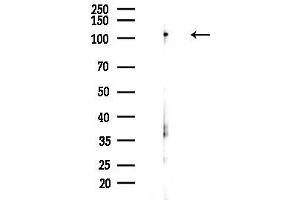anti-Importin 4 (IPO4) (Internal Region) antibody