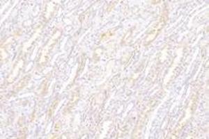 Immunohistochemistry analysis of paraffin-embedded human kidney using,PTGFR (ABIN7075209) at dilution of 1: 800