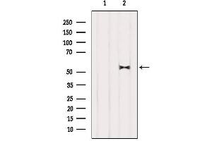 Western blot analysis of extracts from Mouse lung, using HDAC1 Antibody.