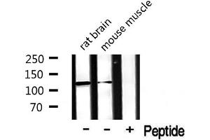 Western blot analysis of extracts from rat and mouse brian, using CDCA2 antibody.