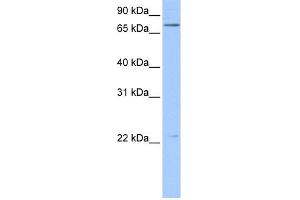 WB Suggested Anti-BFSP1 Antibody Titration:  0. (Filensin anticorps  (N-Term))