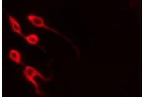 ABIN6277896 staining  Hela cells by IF/ICC. (MYOD1 anticorps  (Internal Region))