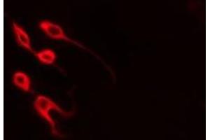 ABIN6277896 staining  Hela cells by IF/ICC.