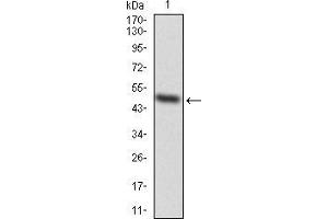 Western blot analysis using EZH2 mAb against human EZH2 (AA: 1-194) recombinant protein. (EZH2 anticorps  (AA 1-194))