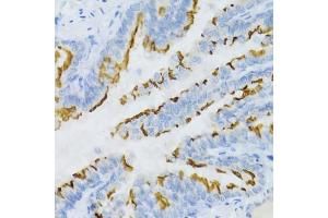 Immunohistochemistry of paraffin-embedded mouse lung using PTGER2 Antibody. (PTGER2 anticorps)