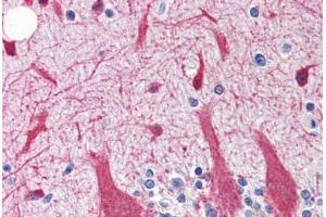 Human Brain, Cerebellum (formalin-fixed, paraffin-embedded) stained with SNCG antibody ABIN364362 at 5 ug/ml followed by biotinylated goat anti-rabbit IgG secondary antibody ABIN481713, alkaline phosphatase-streptavidin and chromogen. (SNCG anticorps)
