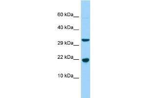 WB Suggested Anti-CABP5 Antibody Titration: 1. (CABP5 anticorps  (N-Term))