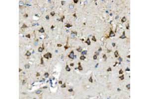 IHC analysis of Thioredoxin 2/TXN2 using anti-Thioredoxin 2/TXN2 antibody (ABIN7602148). (TXN2 anticorps  (AA 60-166))